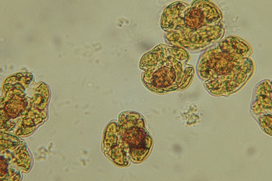 Red tide algae cells under the microscope