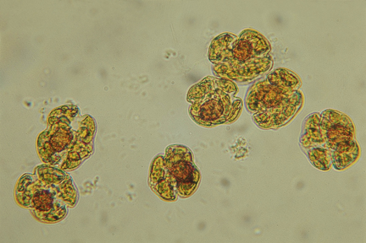 Cells of Karenia brevis, or Florida red tide.