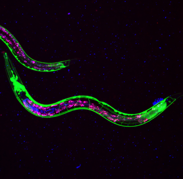 Caenorhabditis elegans (C. elegans) strain with GFP-tagged cholinergic neurons — fluorescent image of microscopic worm used in biomedical research