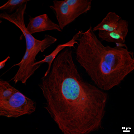 A line of glioblastoma cells that serve as a useful model for studying DNA damage repair in the brain. Credit: NeuroWise Laboratory of Environmental Toxicology, University of Toledo